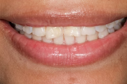 Before